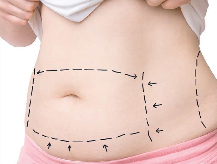 cirurgia-plastica "Especialista em cirurgias"