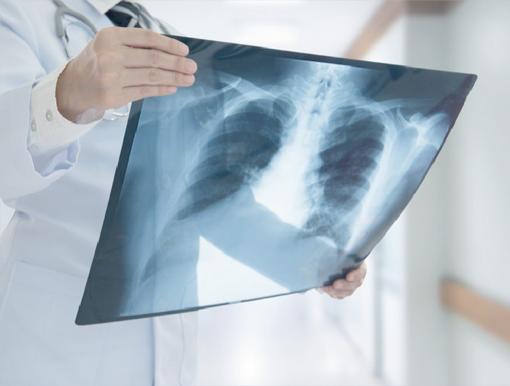 cirurgia-toracica "Especialista em cirurgias"