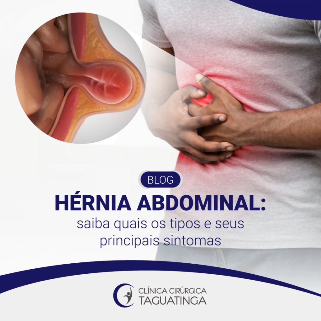 Conheça os tipos de hérnia abdominal - Hernia Clinic